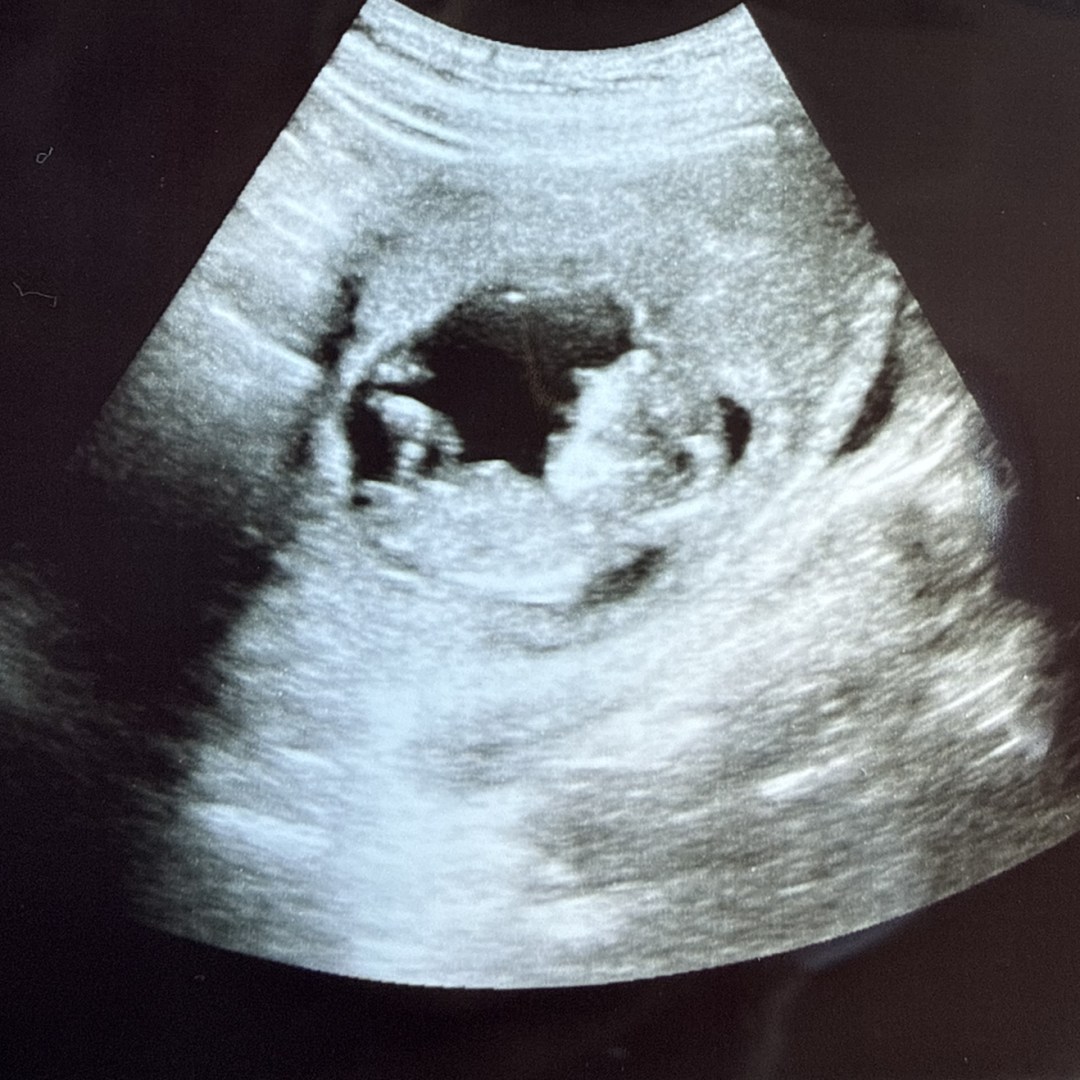 Photo shared by Alannah for their Babylist baby registry.