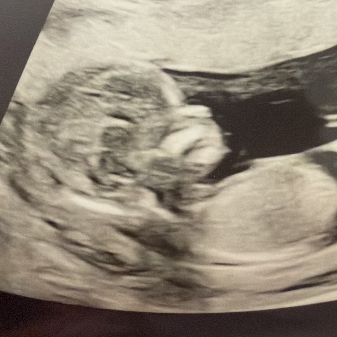 Photo shared by Kailee for their Babylist baby registry.