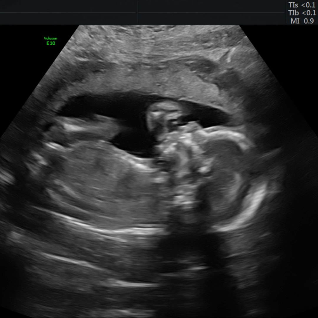 Photo shared by Monique for their Babylist baby registry.