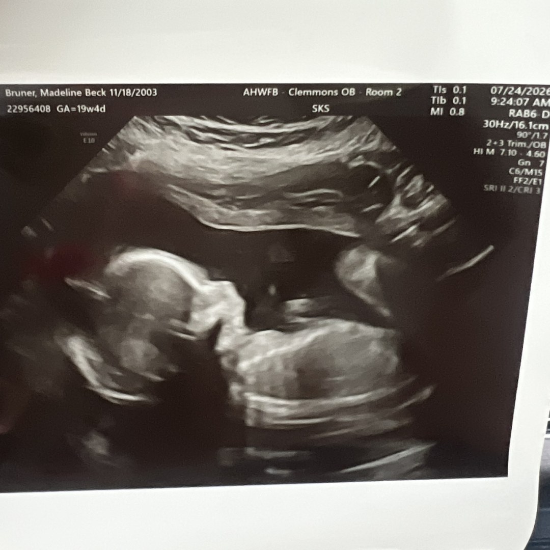 Photo shared by Mattie for their Babylist baby registry.