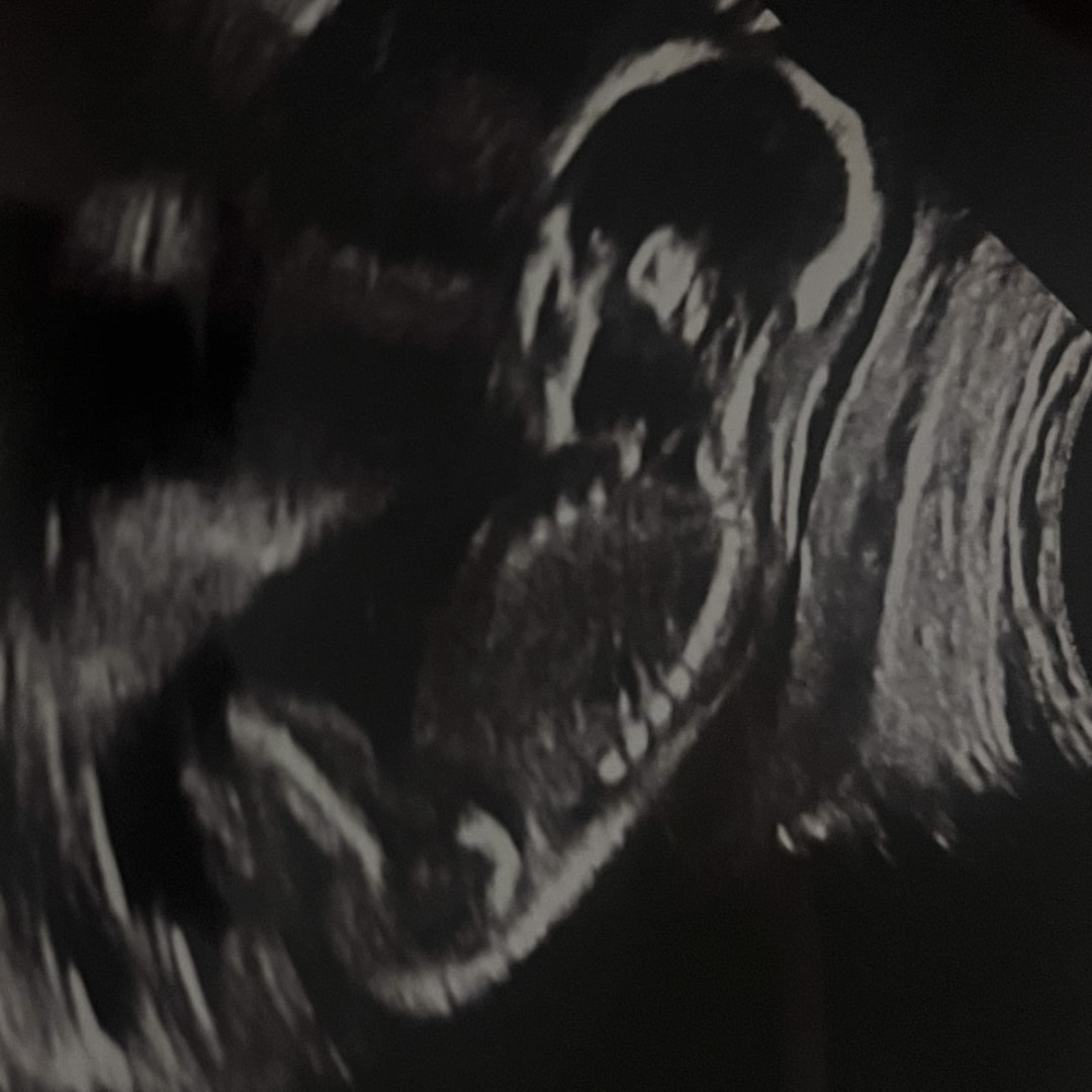 Photo shared by Emily for their Babylist baby registry.