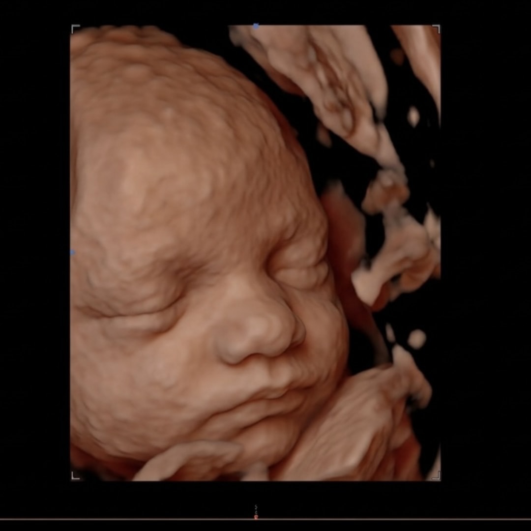 Photo shared by Jamie for their Babylist baby registry.