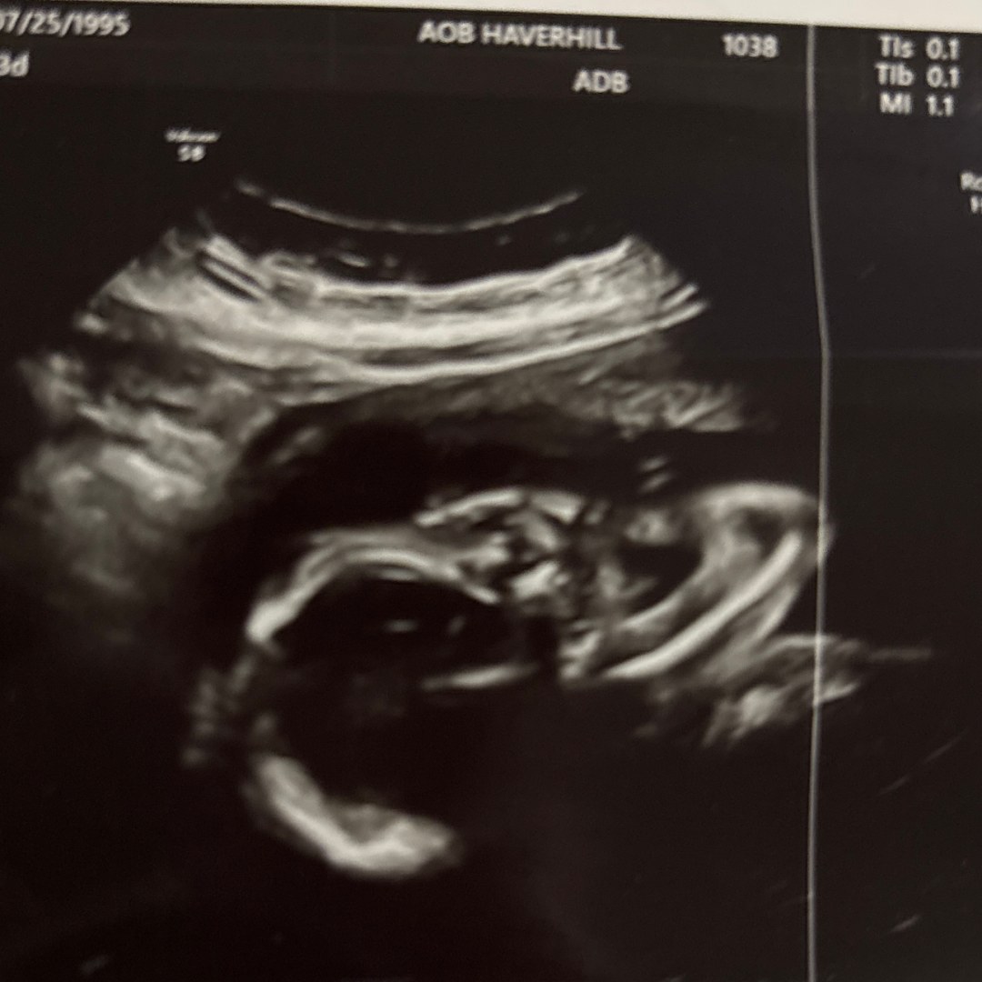 Photo shared by Fabiola for their Babylist baby registry.