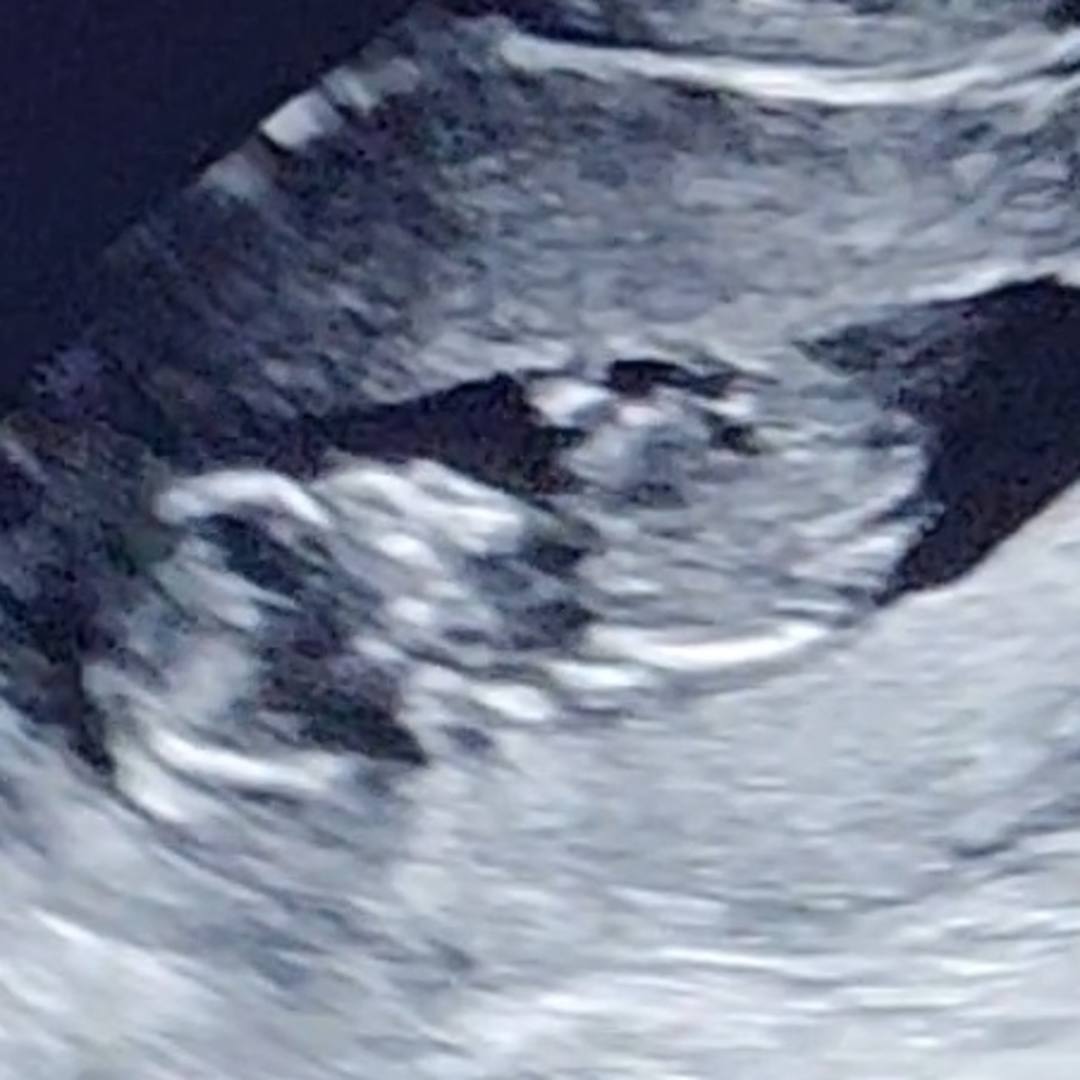 Photo shared by Sam for their Babylist baby registry.