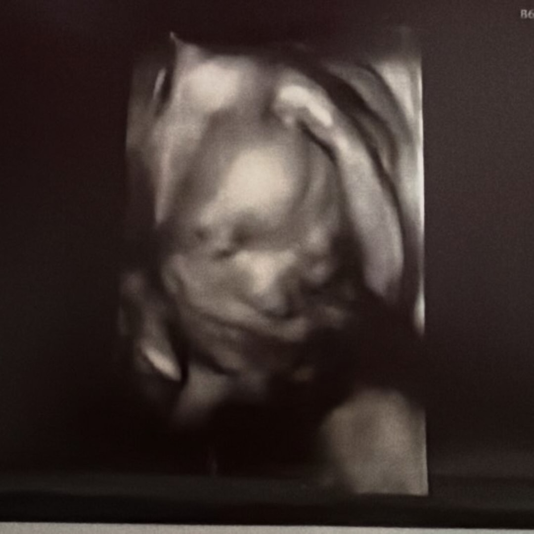 Photo shared by Savannah for their Babylist baby registry.