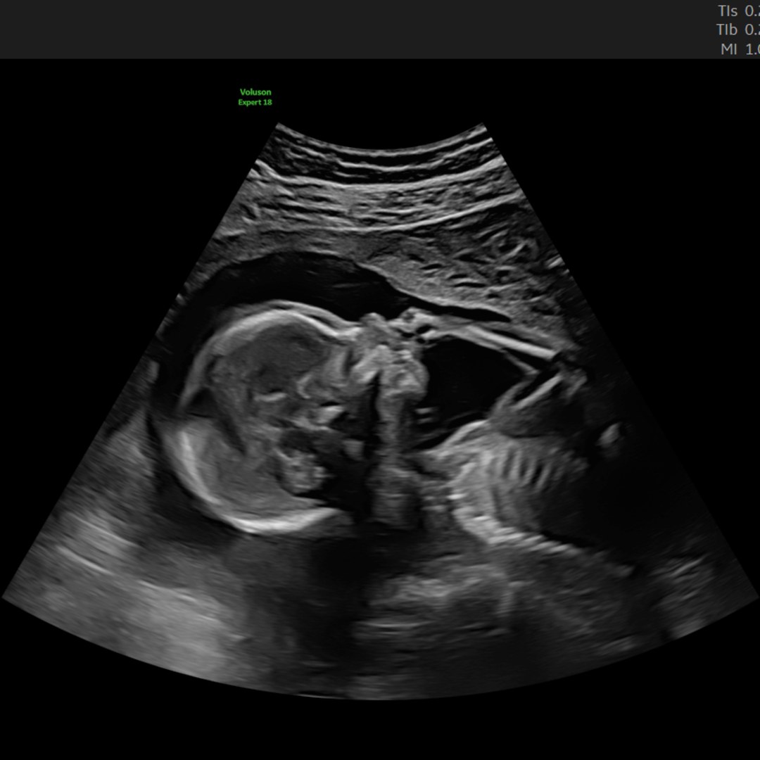 Photo shared by Shea for their Babylist baby registry.