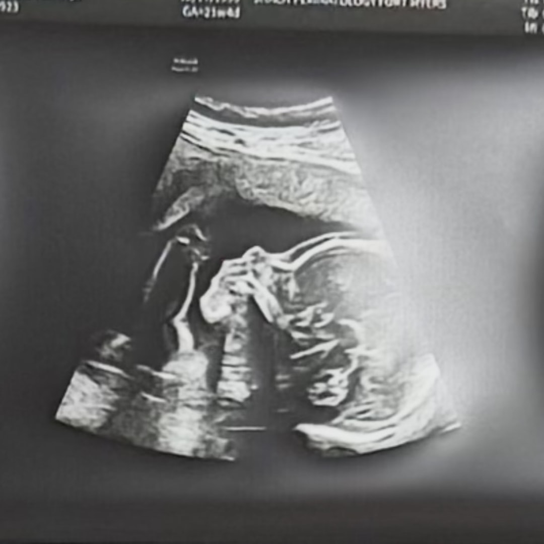 Photo shared by Vanessa for their Babylist baby registry.
