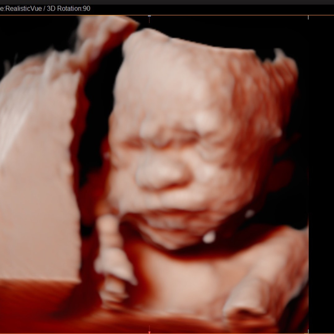 Photo shared by Rileigh for their Babylist baby registry.