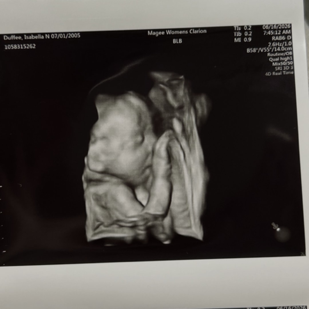 Photo shared by Isabella for their Babylist baby registry.