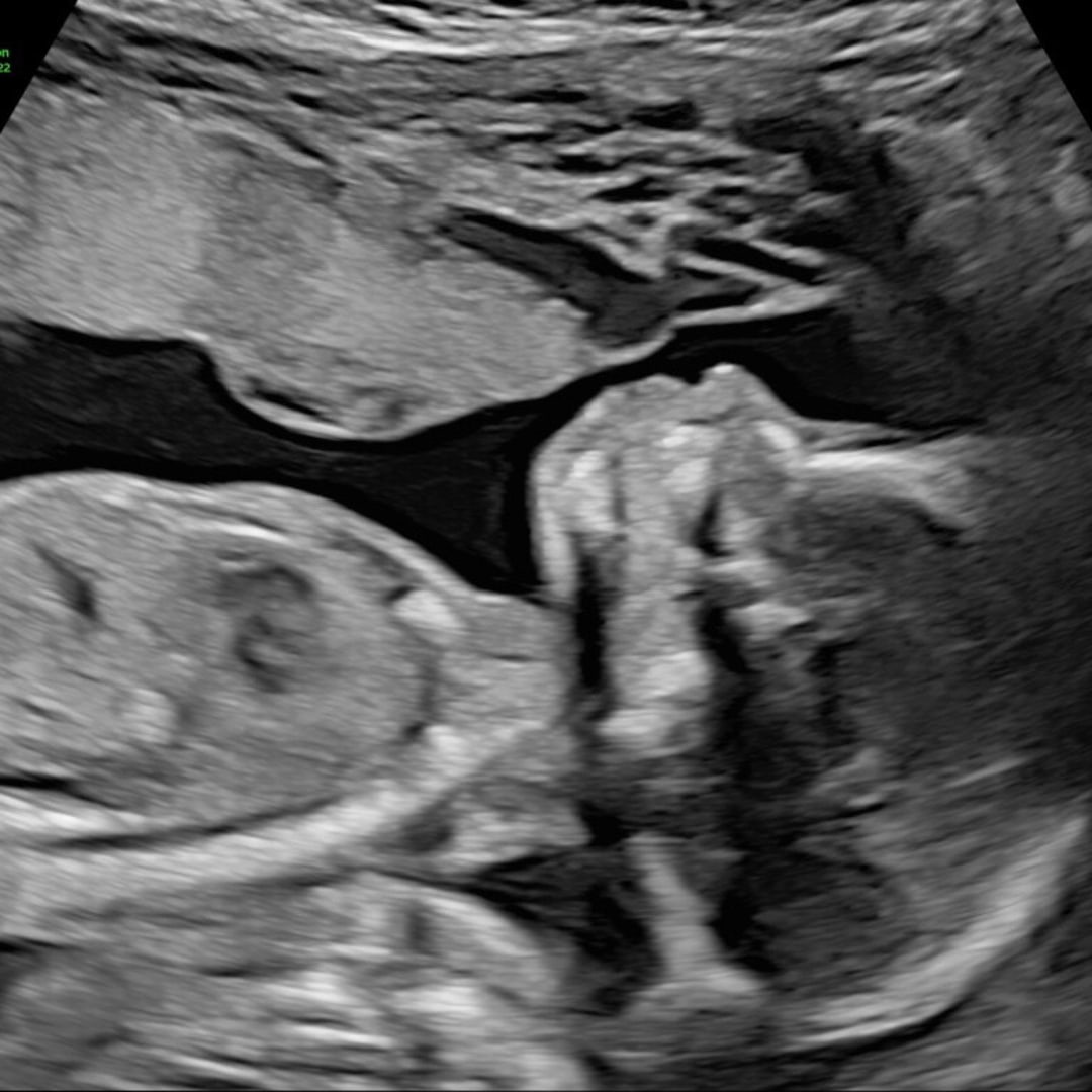 Photo shared by Camia for their Babylist baby registry.