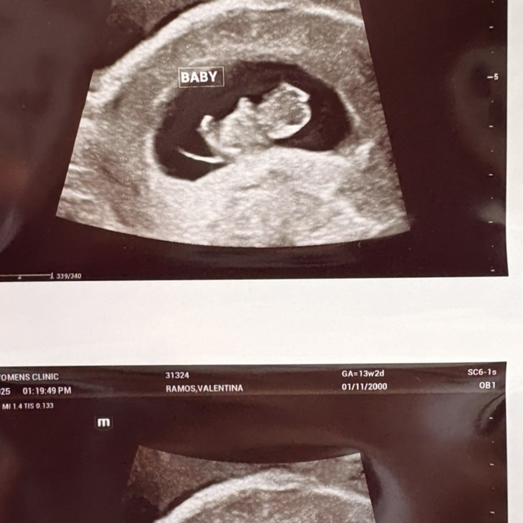 Photo shared by Valentina for their Babylist baby registry.