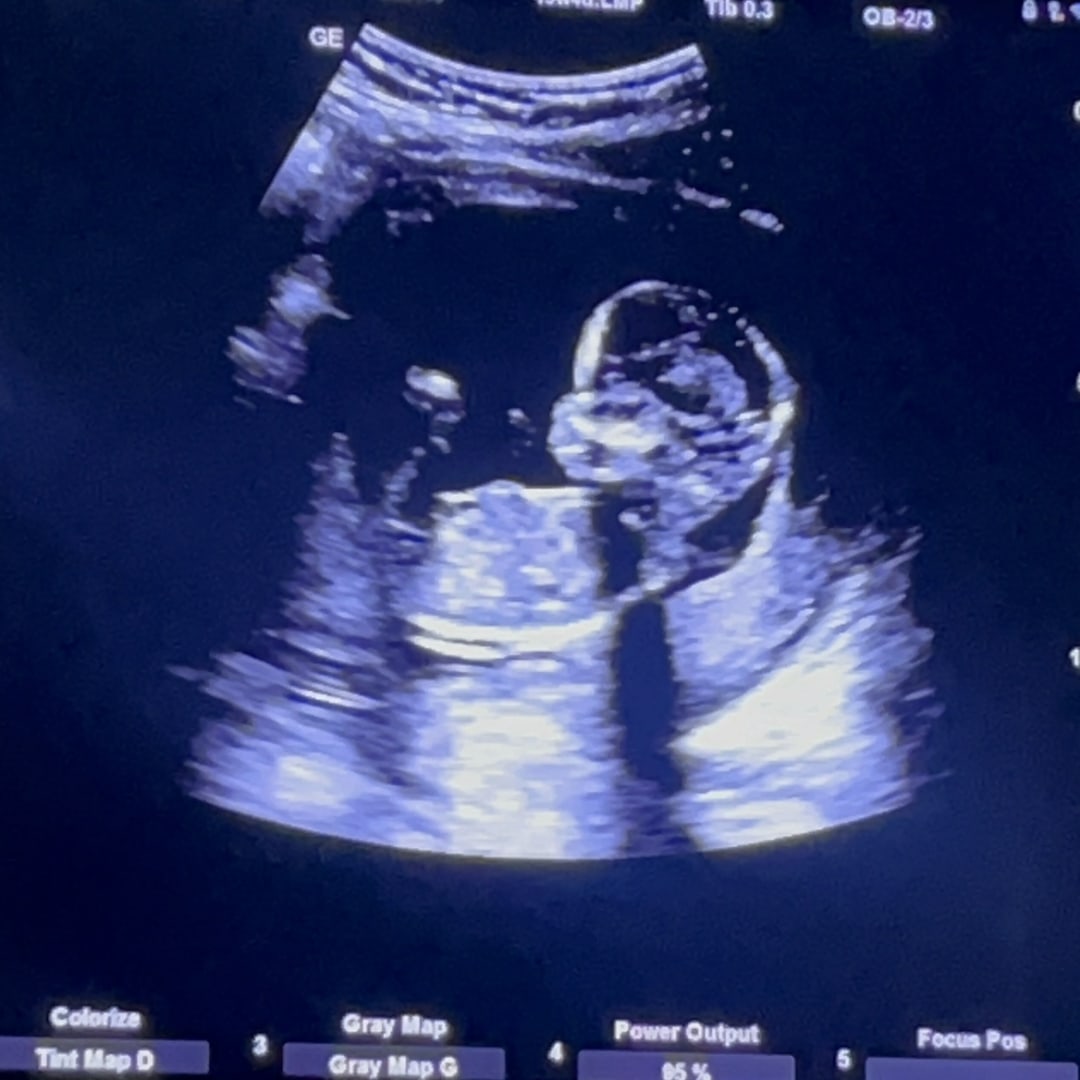 Photo shared by PrincessZoie for their Babylist baby registry.