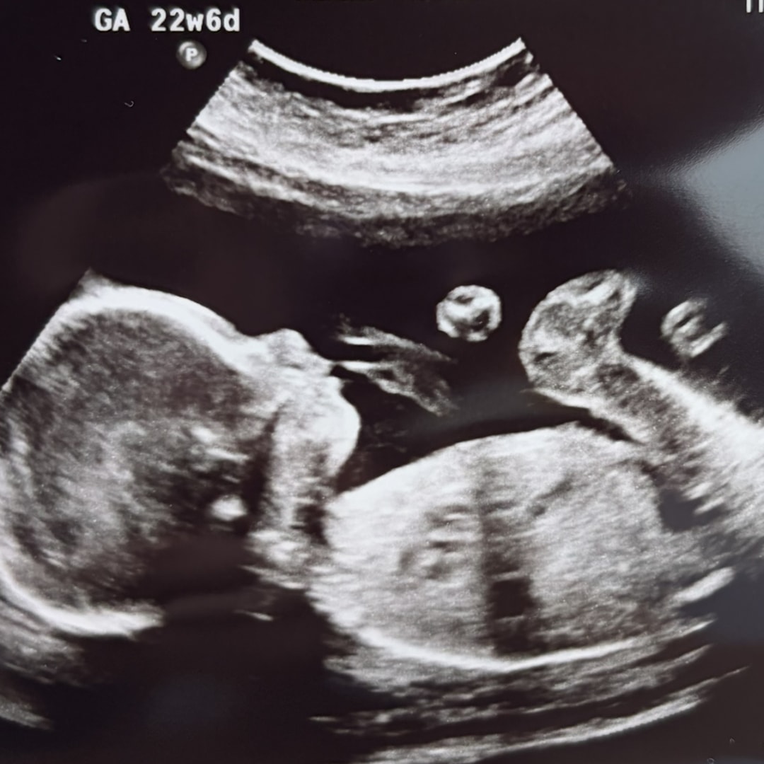 Photo shared by Enery for their Babylist baby registry.