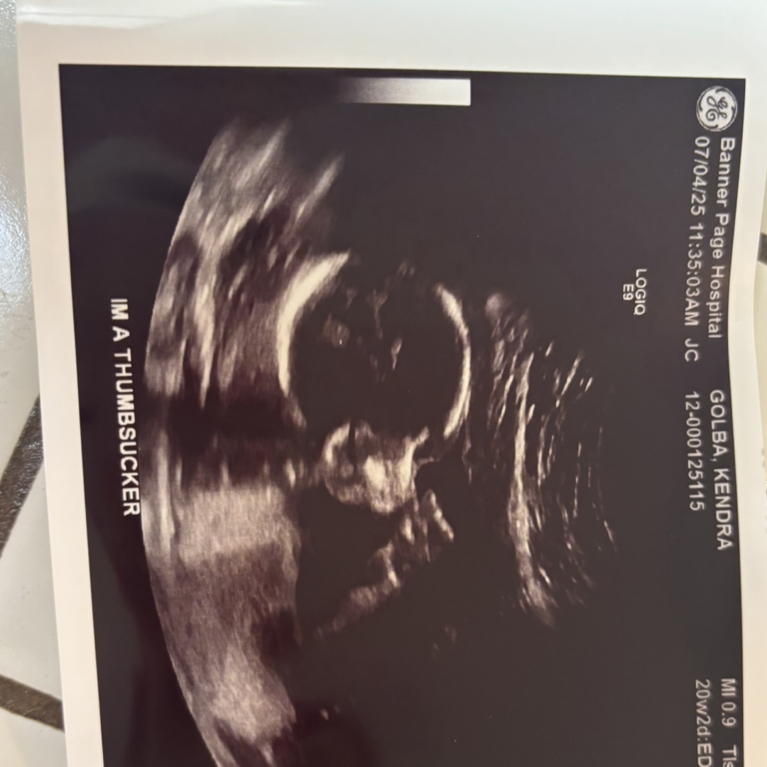 Photo shared by Kendra for their Babylist baby registry.