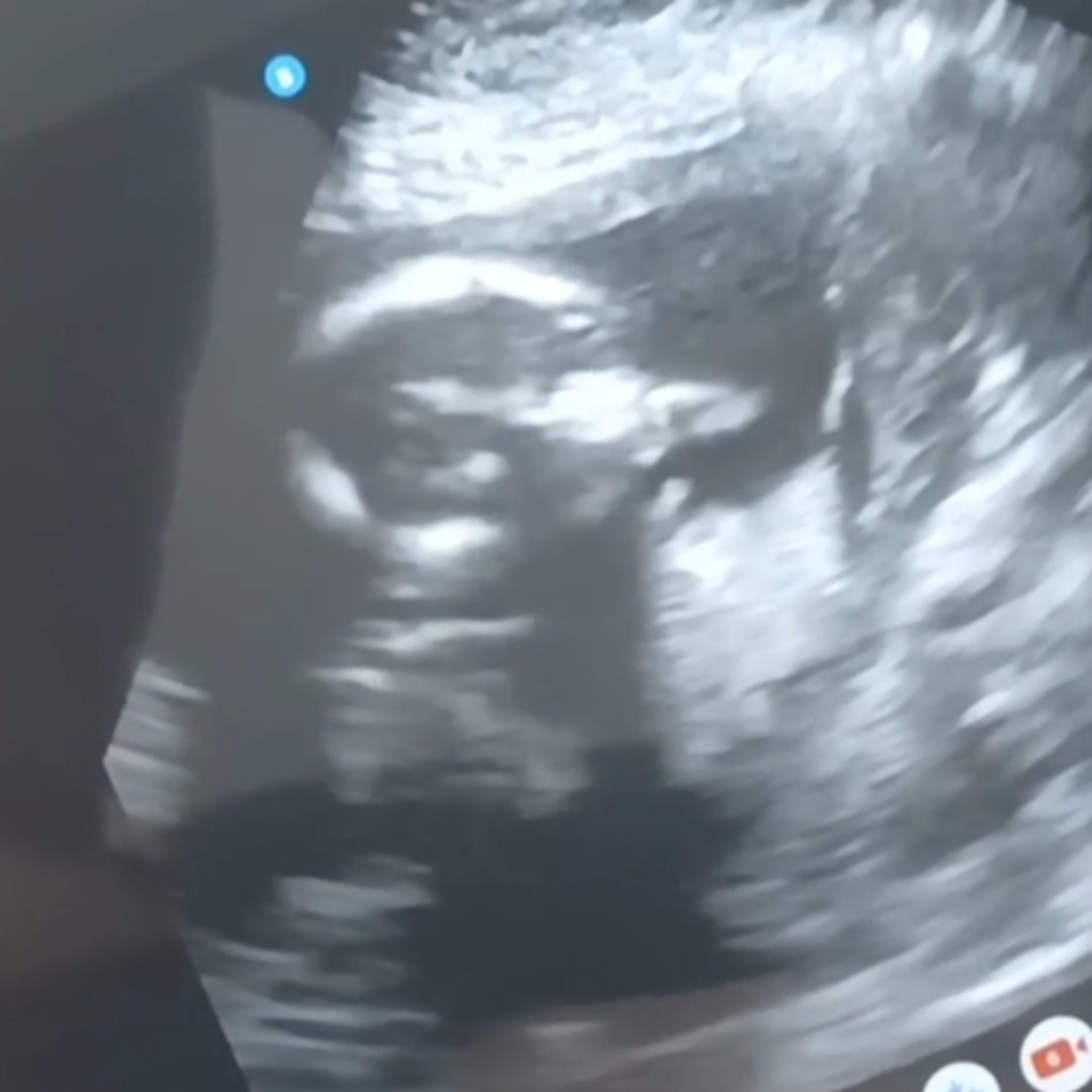 Photo shared by Ashley for their Babylist baby registry.