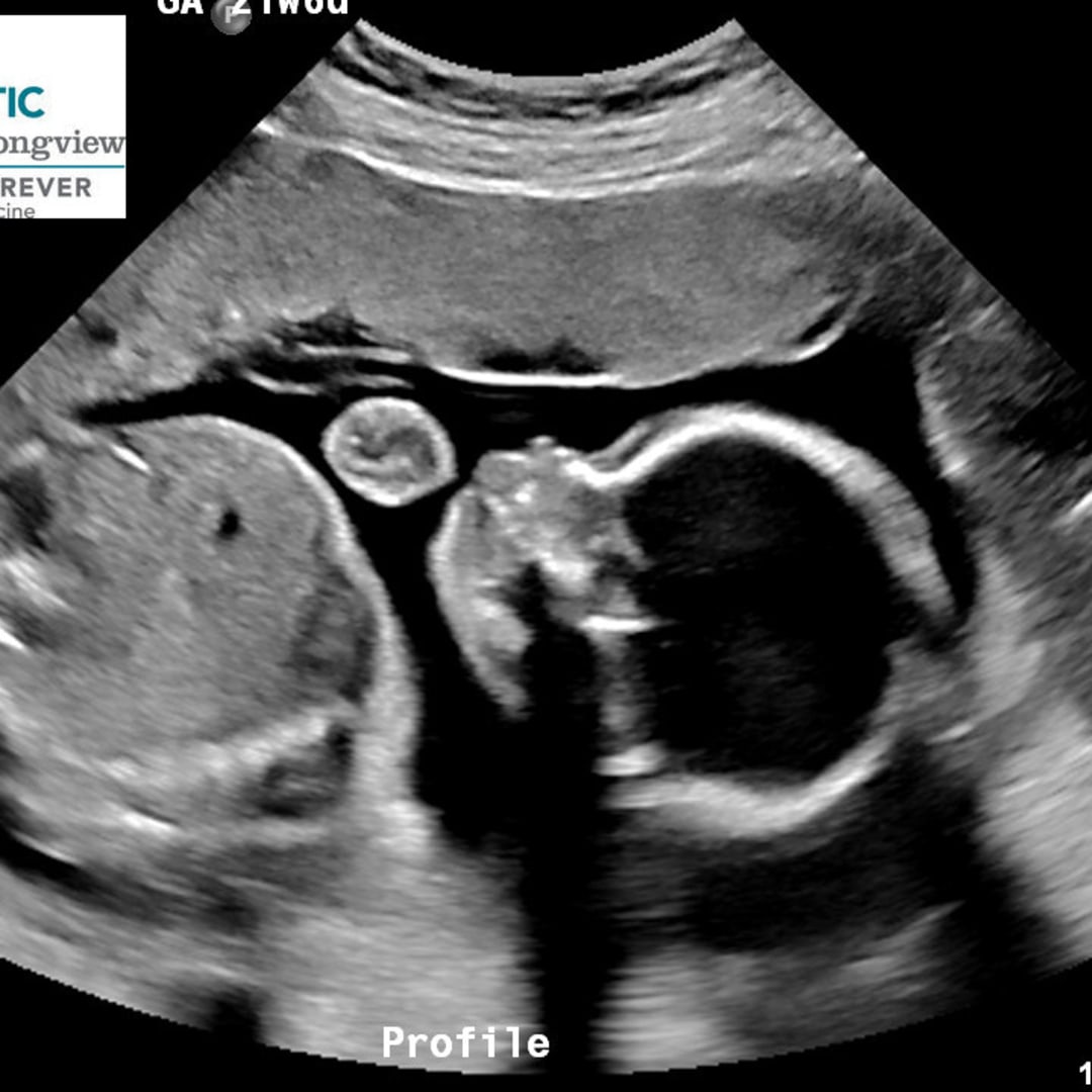 Photo shared by Alexa-Rae for their Babylist baby registry.
