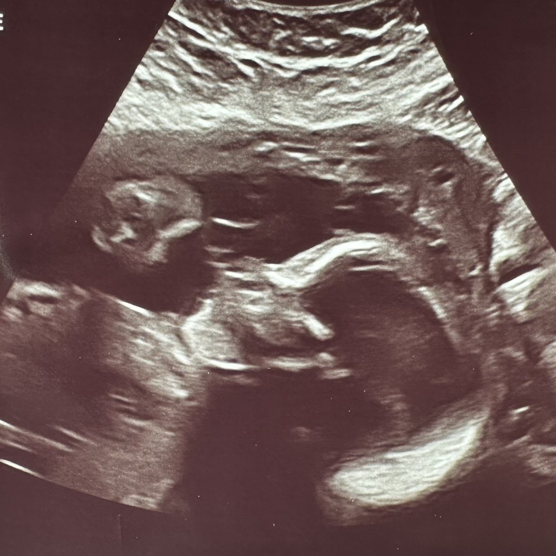 Photo shared by Hayley for their Babylist baby registry.