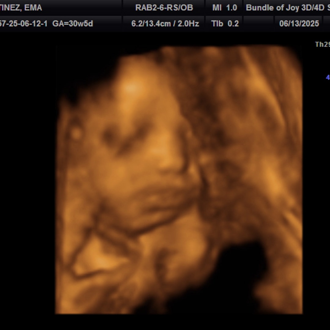 Photo shared by Ema for their Babylist baby registry.