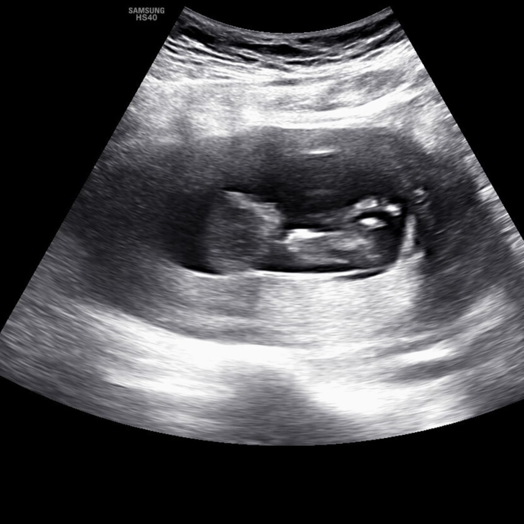 Photo shared by Taylor for their Babylist baby registry.