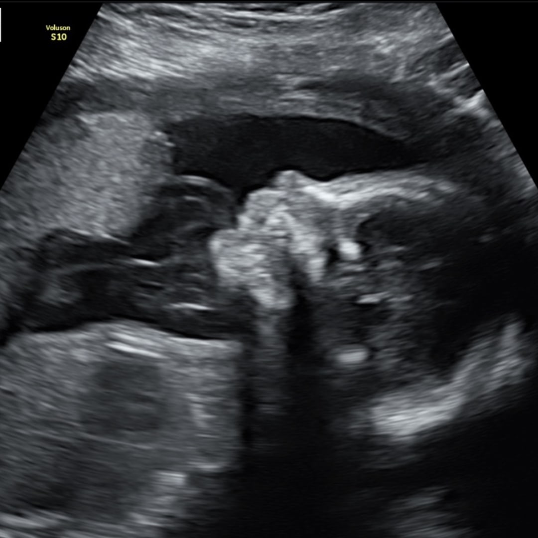 Photo shared by Rielly for their Babylist baby registry.