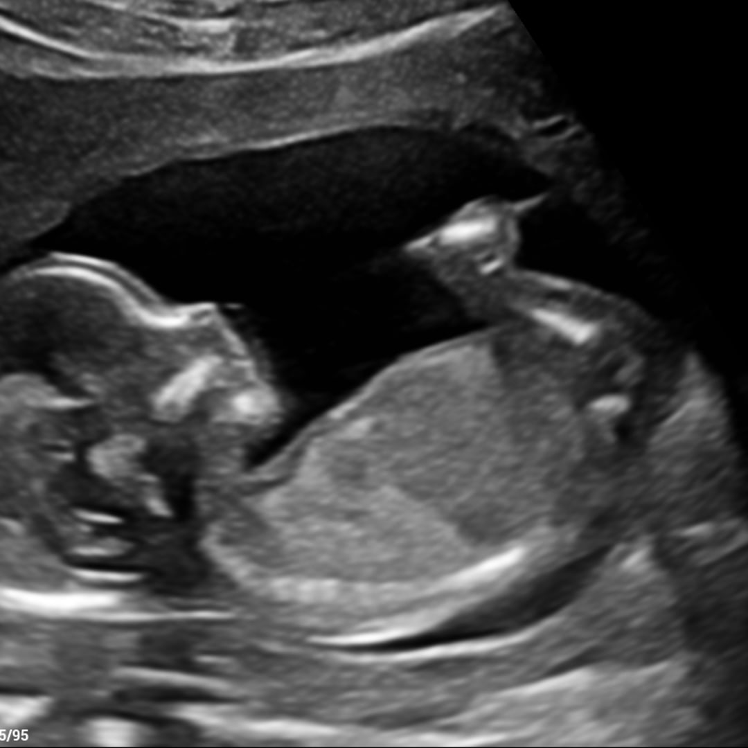 Photo shared by Kelsey for their Babylist baby registry.