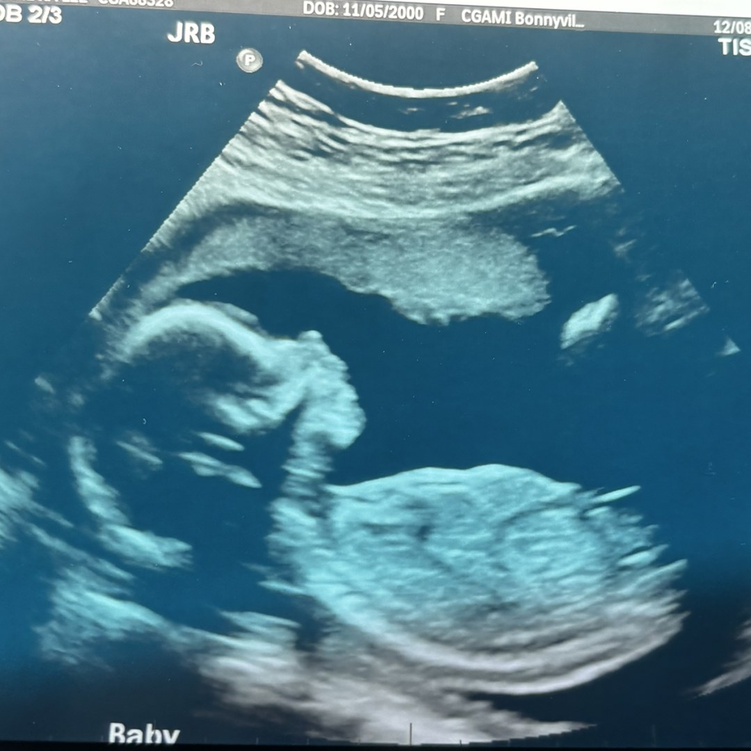 Photo shared by Kandra for their Babylist baby registry.