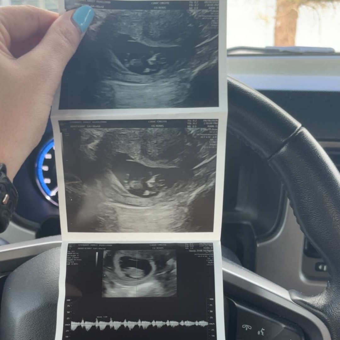 Photo shared by Emily for their Babylist baby registry.