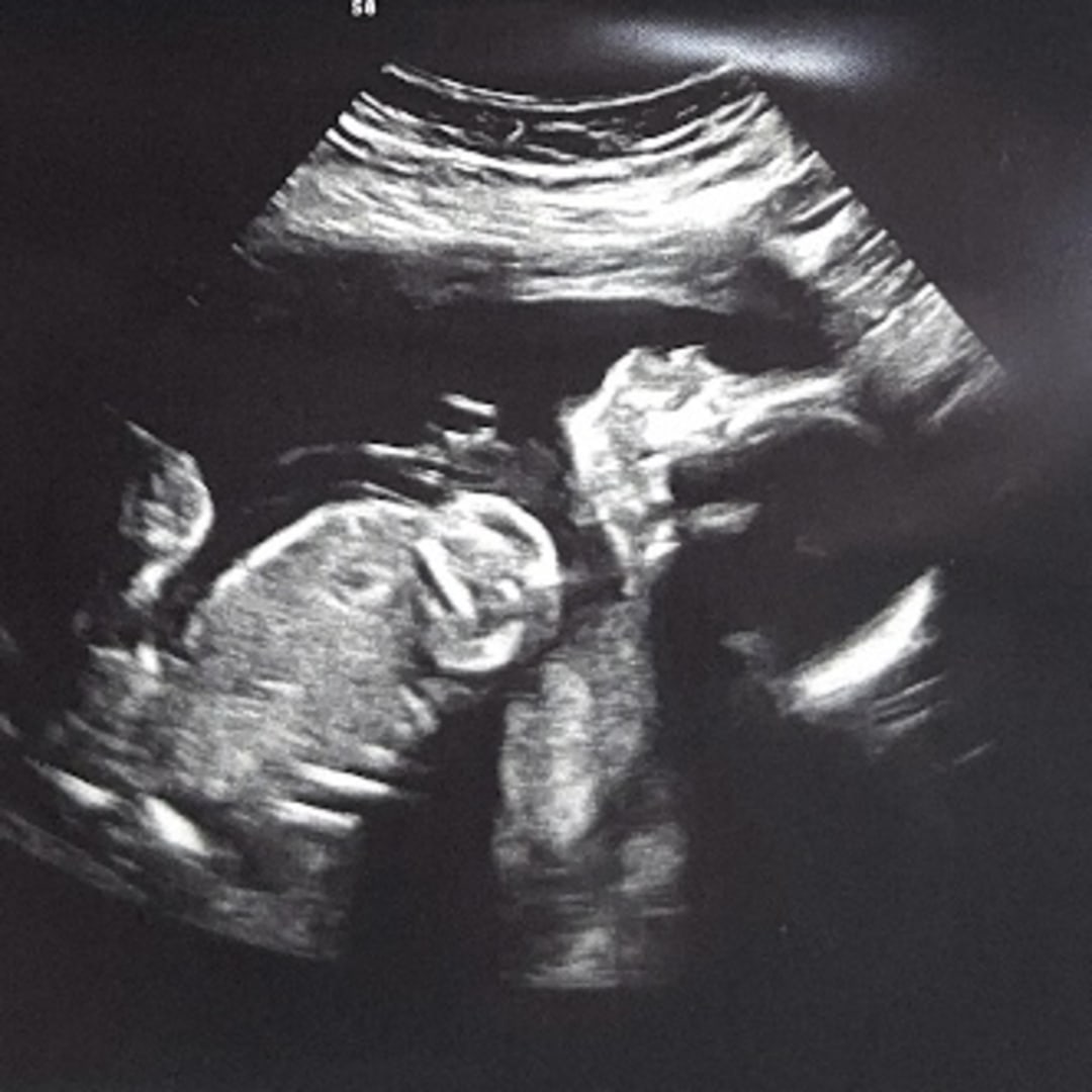 Photo shared by Darlene for their Babylist baby registry.