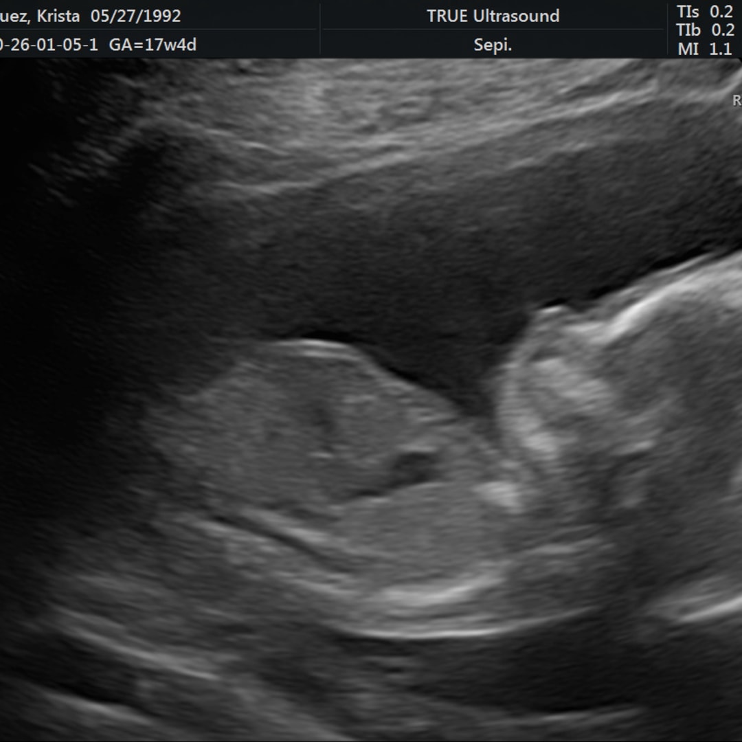 Photo shared by Krista for their Babylist baby registry.