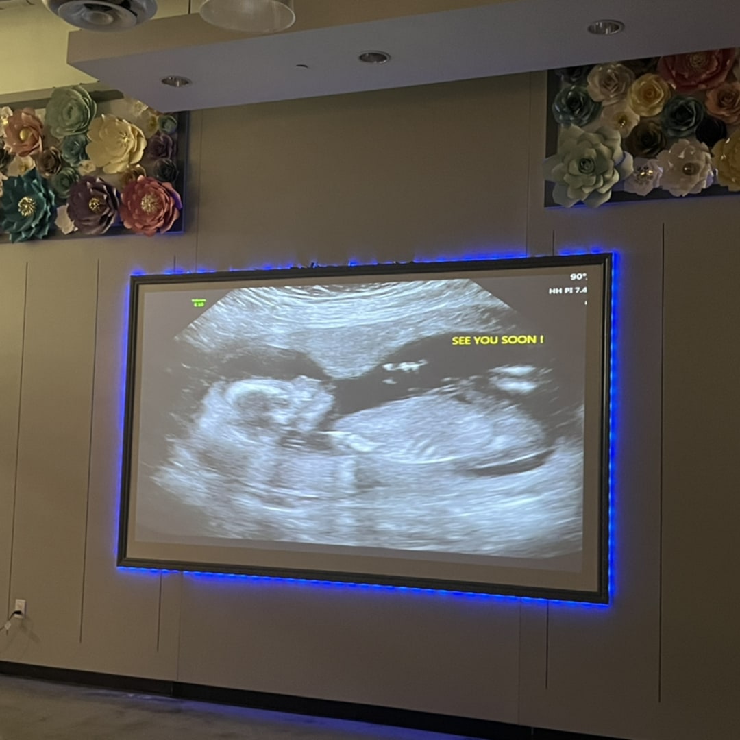 Photo shared by Dariana for their Babylist baby registry.