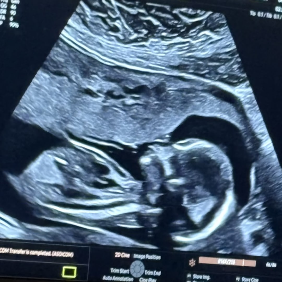 Photo shared by Carla for their Babylist baby registry.