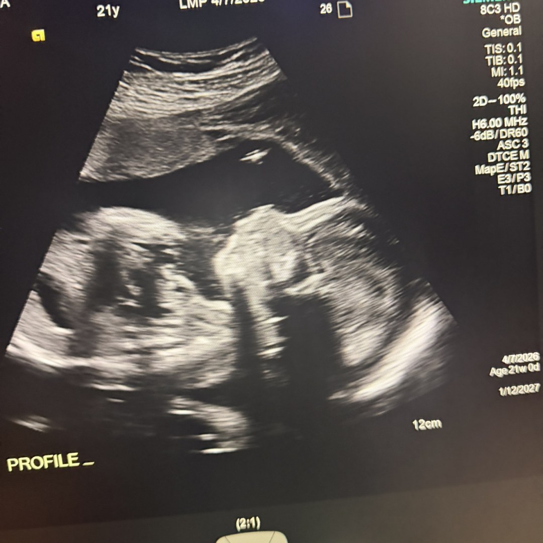 Photo shared by Angelina for their Babylist baby registry.