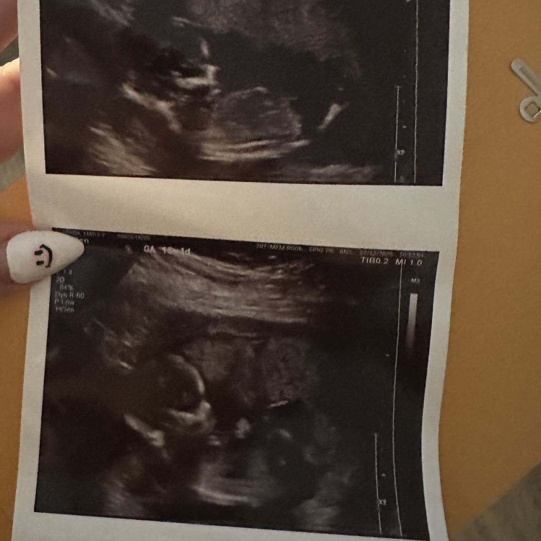 Photo shared by Emily for their Babylist baby registry.