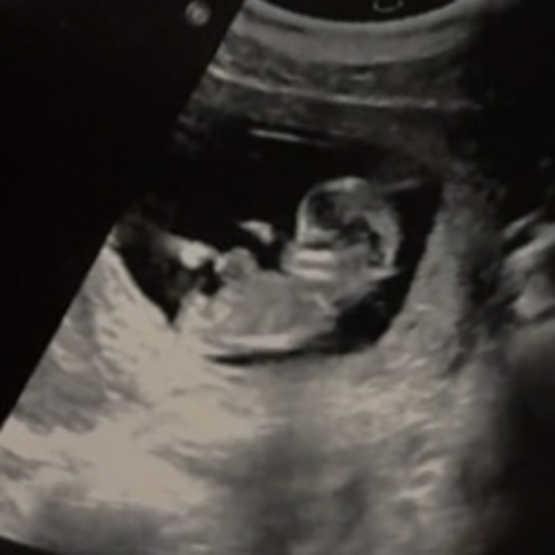 Photo shared by Kaley for their Babylist baby registry.