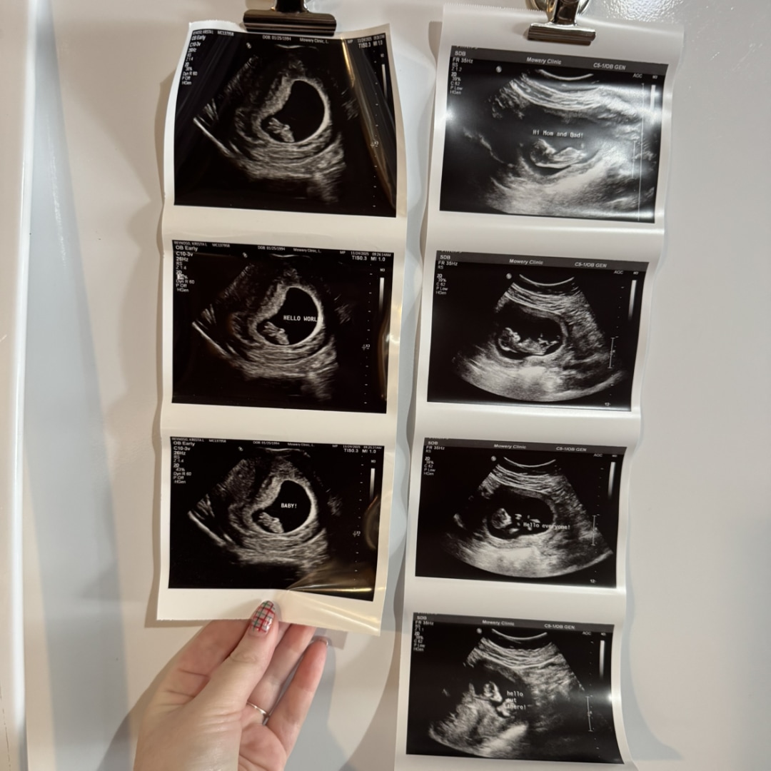 Photo shared by Krista for their Babylist baby registry.