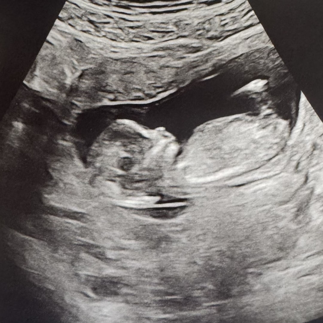 Photo shared by Kaelyn for their Babylist baby registry.
