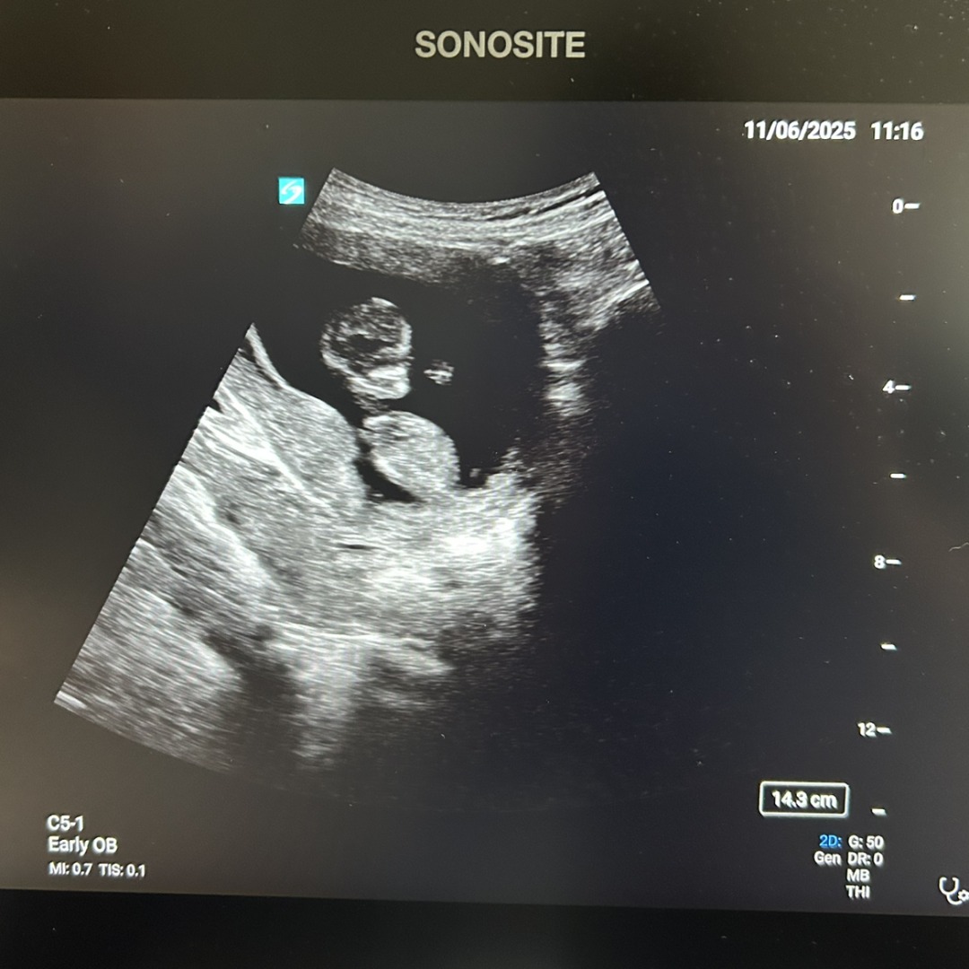 Photo shared by Emma for their Babylist baby registry.