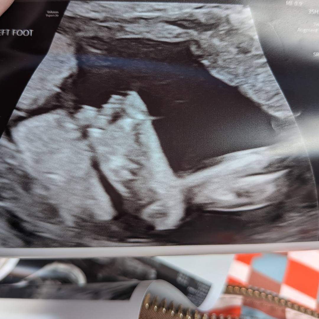 Photo shared by Emily for their Babylist baby registry.