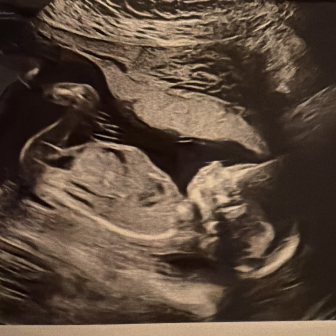 Photo shared by Kristen for their Babylist baby registry.