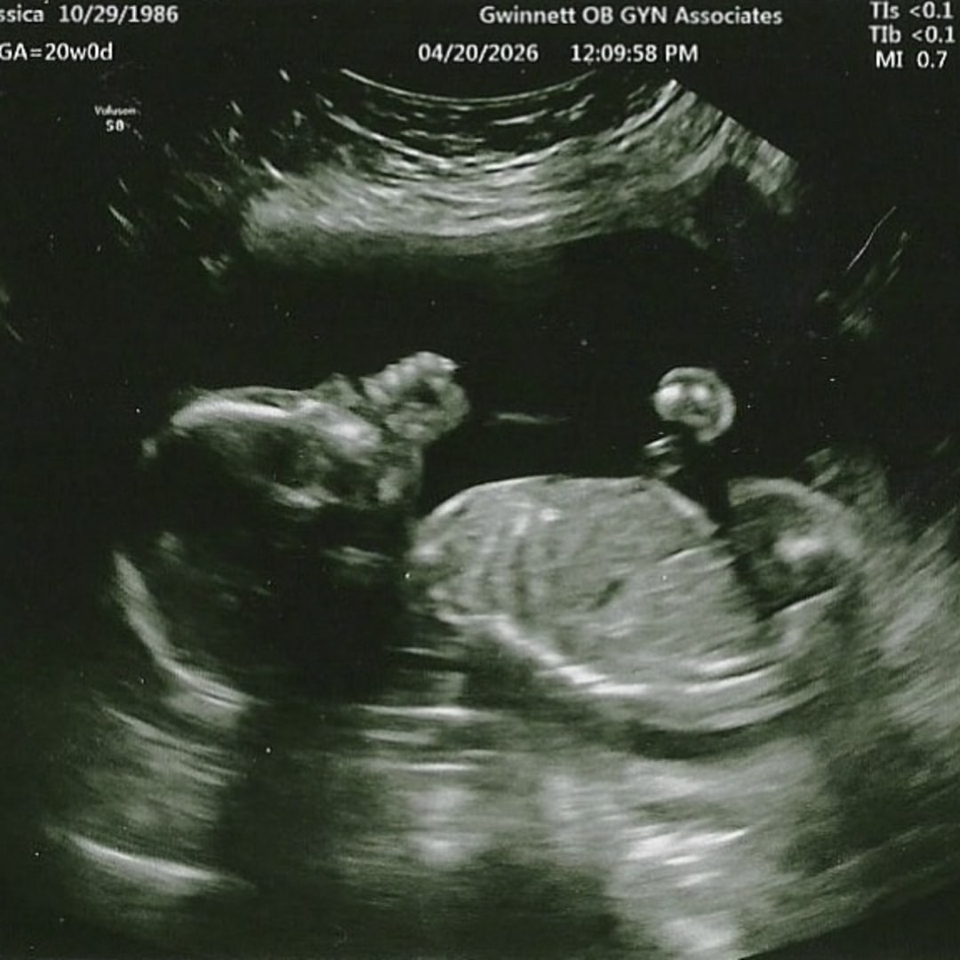 Photo shared by Jessica for their Babylist baby registry.