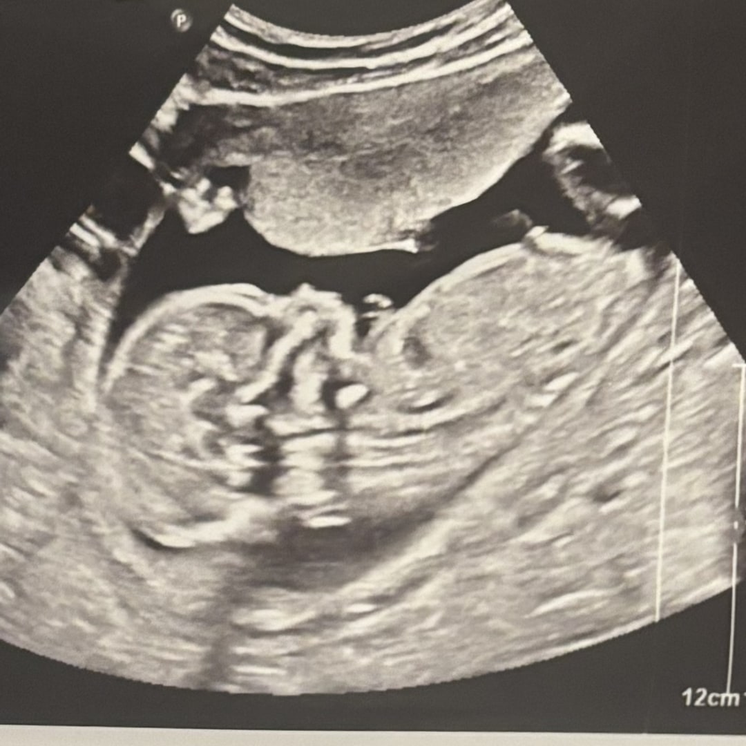 Photo shared by Deniris for their Babylist baby registry.