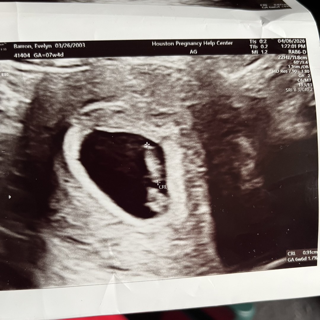 Photo shared by Evelyn for their Babylist baby registry.