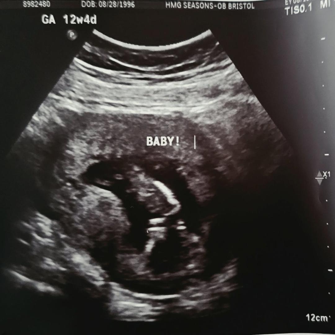 Photo shared by Kathleen for their Babylist baby registry.