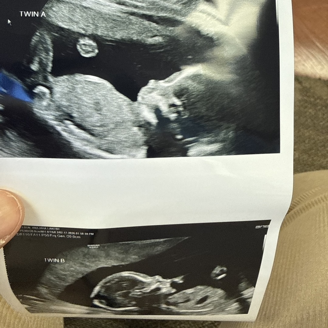 Photo shared by A’najaha for their Babylist baby registry.