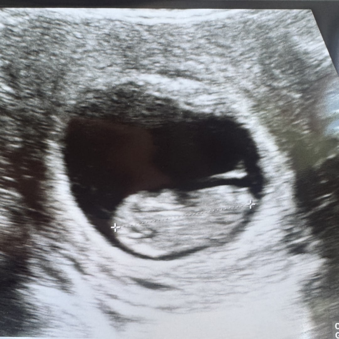 Photo shared by Jayli for their Babylist baby registry.