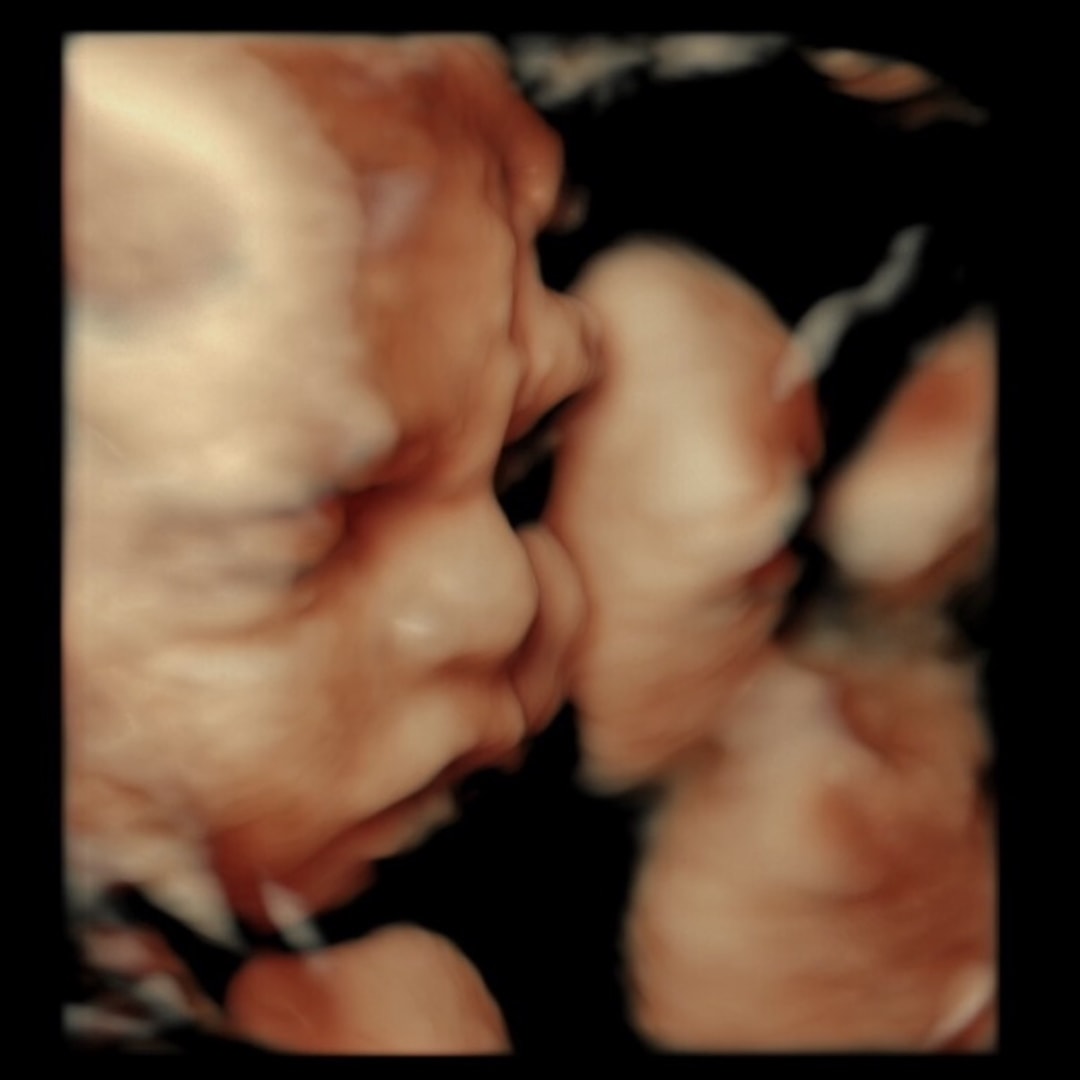 Photo shared by Jasmine for their Babylist baby registry.