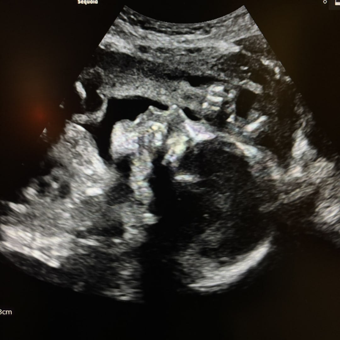 Photo shared by Desirae for their Babylist baby registry.