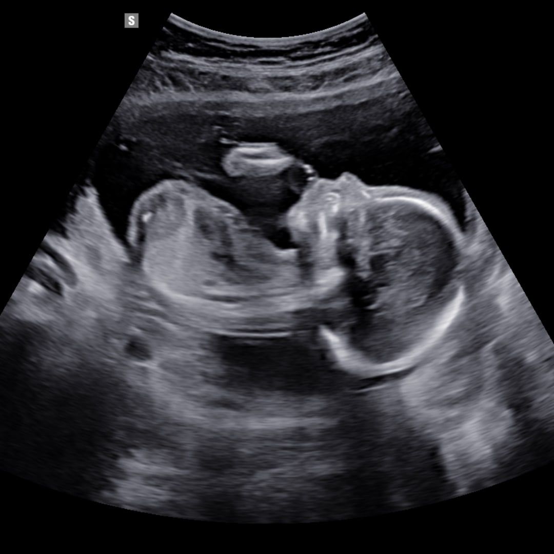 Photo shared by Frankie for their Babylist baby registry.