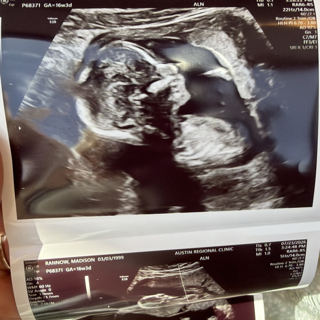 Photo shared by Madison for their Babylist baby registry.