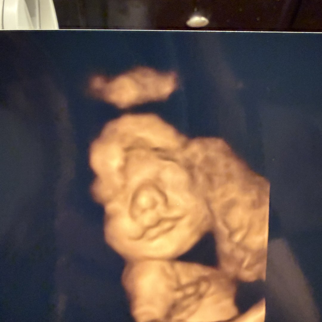 Photo shared by Rachel for their Babylist baby registry.